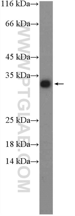 HDHD2 Rabbit anti-Human, Mouse, Polyclonal, Proteintech:Antibodies:Primary