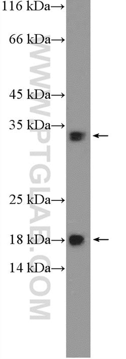 HDHD2 Rabbit anti-Human, Mouse, Polyclonal, Proteintech:Antibodies:Primary