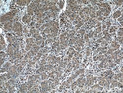 Il2 Rabbit anti-Human, Mouse, Polyclonal, Proteintech 150 &mu;L; Unconjugated:Antibodies,