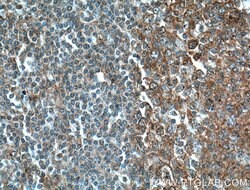 Il2 Rabbit anti-Human, Mouse, Polyclonal, Proteintech 150 &mu;L; Unconjugated:Antibodies,