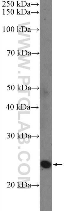 SNAI1 Rabbit anti-Human, Mouse, Polyclonal, Proteintech:Antibodies:Primary