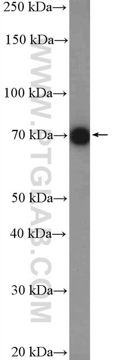 DRP1 (N-terminal) Rabbit anti-Human, Mouse, Polyclonal, Proteintech:Antibodies:Primary