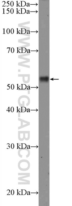RPS6KB2 Rabbit anti-Human, Polyclonal, Proteintech 20 &mu;L; Unconjugated:Antibodies,