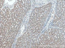 Piezo2 Rabbit anti-Human, Polyclonal, Proteintech:Antibodies:Primary Antibodies
