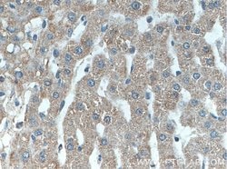 Piezo2 Rabbit anti-Human, Polyclonal, Proteintech:Antibodies:Primary Antibodies