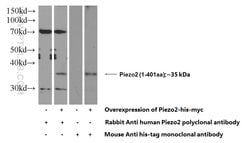 Piezo2 Rabbit anti-Human, Polyclonal, Proteintech:Antibodies:Primary Antibodies