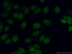C11orf30 Rabbit anti-Human, Polyclonal, Proteintech 150 &mu;L; Unconjugated:Antibodies,