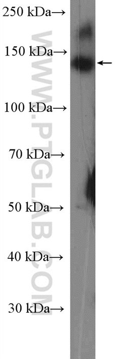 C11orf30 Rabbit anti-Human, Polyclonal, Proteintech 150 &mu;L; Unconjugated:Antibodies,