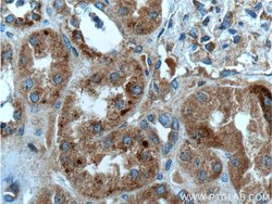 FAHD1 Rabbit anti-Human, Polyclonal, Proteintech:Antibodies:Primary Antibodies