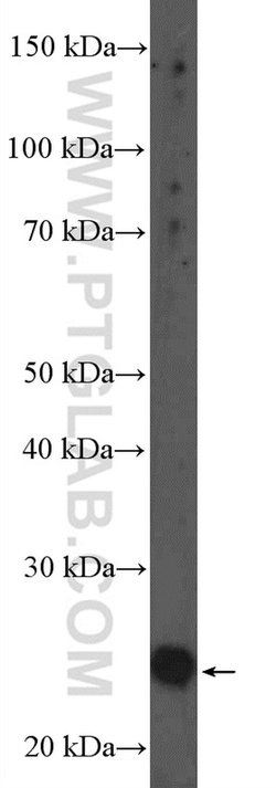 FAHD1 Rabbit anti-Human, Polyclonal, Proteintech:Antibodies:Primary Antibodies