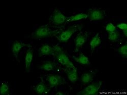 DLX2 Rabbit anti-Human, Mouse, Polyclonal, Proteintech:Antibodies:Primary