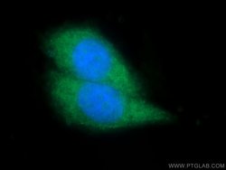 TAOK1 Rabbit anti-Human, Mouse, Polyclonal, Proteintech:Antibodies:Primary