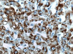TAOK1 Rabbit anti-Human, Mouse, Polyclonal, Proteintech:Antibodies:Primary