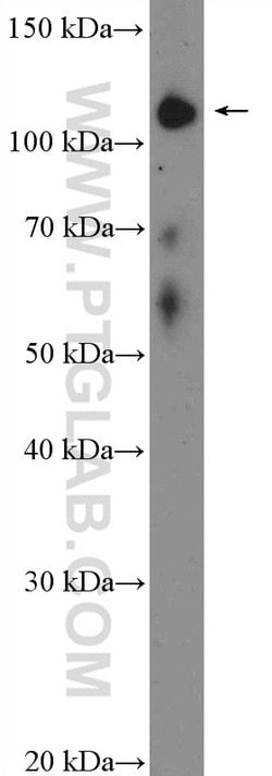 TAOK1 Rabbit anti-Human, Mouse, Polyclonal, Proteintech:Antibodies:Primary