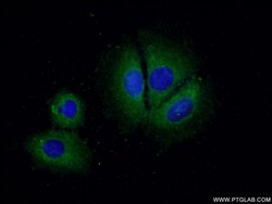 CCM2 Rabbit anti-Human, Polyclonal, Proteintech:Antibodies:Primary Antibodies