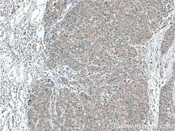 CCM2 Rabbit anti-Human, Polyclonal, Proteintech:Antibodies:Primary Antibodies