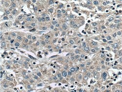 CCM2 Rabbit anti-Human, Polyclonal, Proteintech:Antibodies:Primary Antibodies