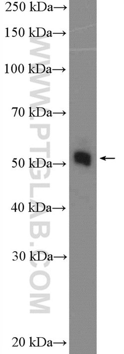 CCM2 Rabbit anti-Human, Polyclonal, Proteintech:Antibodies:Primary Antibodies
