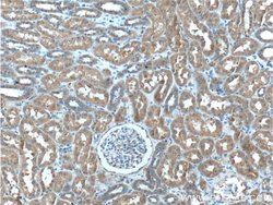 C8orf4 Rabbit anti-Human, Mouse, Polyclonal, Proteintech 150 &mu;L; Unconjugated:Antibodies,