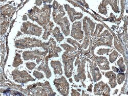 C8orf4 Rabbit anti-Human, Mouse, Polyclonal, Proteintech 150 &mu;L; Unconjugated:Antibodies,