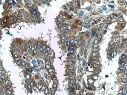 C8orf4 Rabbit anti-Human, Mouse, Polyclonal, Proteintech 150 &mu;L; Unconjugated:Antibodies,