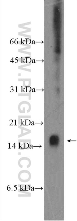 C8orf4 Rabbit anti-Human, Mouse, Polyclonal, Proteintech 150 &mu;L; Unconjugated:Antibodies,