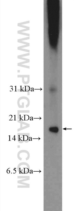 C8orf4 Rabbit anti-Human, Mouse, Polyclonal, Proteintech 150 &mu;L; Unconjugated:Antibodies,