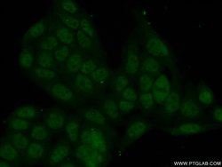 ZBTB1 Rabbit anti-Human, Polyclonal, Proteintech:Antibodies:Primary Antibodies