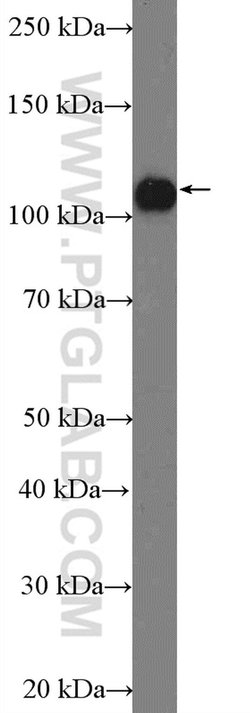 ANKLE2 Rabbit anti-Human, Polyclonal, Proteintech:Antibodies:Primary Antibodies