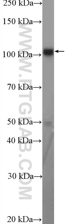 ANKLE2 Rabbit anti-Human, Polyclonal, Proteintech:Antibodies:Primary Antibodies