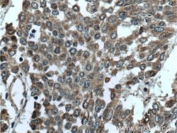 DALRD3 Rabbit anti-Human, Polyclonal, Proteintech 150 &mu;L; Unconjugated:Antibodies,