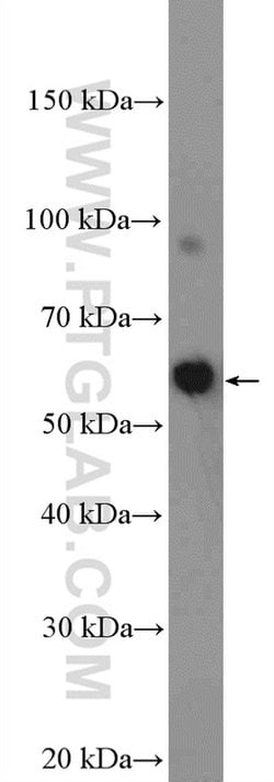 DALRD3 Rabbit anti-Human, Polyclonal, Proteintech 150 &mu;L; Unconjugated:Antibodies,