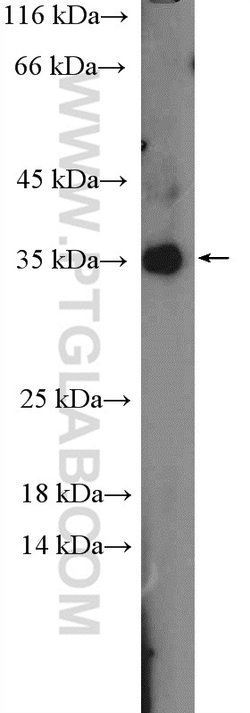 C19orf54 Rabbit anti-Human, Mouse, Polyclonal, Proteintech 20 &mu;L; Unconjugated:Antibodies,