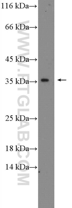 C19orf54 Rabbit anti-Human, Mouse, Polyclonal, Proteintech 20 &mu;L; Unconjugated:Antibodies,
