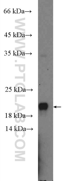 C19orf54 Rabbit anti-Human, Mouse, Polyclonal, Proteintech 20 &mu;L; Unconjugated:Antibodies,