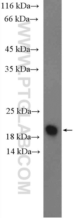 C19orf54 Rabbit anti-Human, Mouse, Polyclonal, Proteintech 20 &mu;L; Unconjugated:Antibodies,