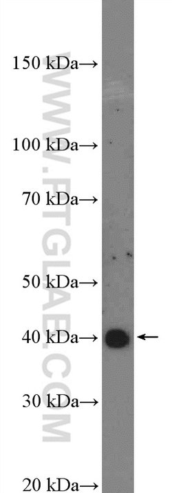 C10orf46 Rabbit anti-Human, Mouse, Polyclonal, Proteintech 150 &mu;L; Unconjugated:Antibodies,