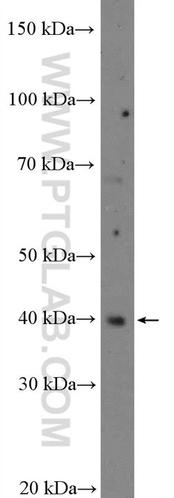 C10orf46 Rabbit anti-Human, Mouse, Polyclonal, Proteintech 150 &mu;L; Unconjugated:Antibodies,