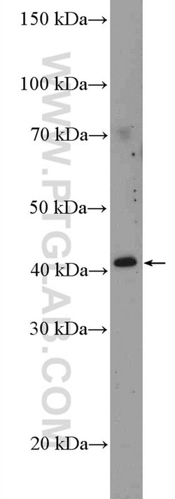C10orf46 Rabbit anti-Human, Mouse, Polyclonal, Proteintech 150 &mu;L; Unconjugated:Antibodies,