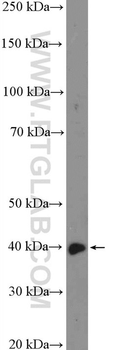 C10orf46 Rabbit anti-Human, Mouse, Polyclonal, Proteintech 150 &mu;L; Unconjugated:Antibodies,
