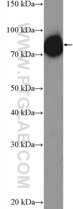C19orf21 Rabbit anti-Human, Polyclonal, Proteintech 150 &mu;L; Unconjugated:Antibodies,