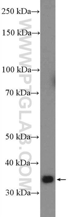 FAM92B Rabbit anti-Human, Mouse, Polyclonal, Proteintech:Antibodies:Primary
