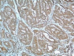 LHCGR Rabbit anti-Human, Mouse, Polyclonal, Proteintech