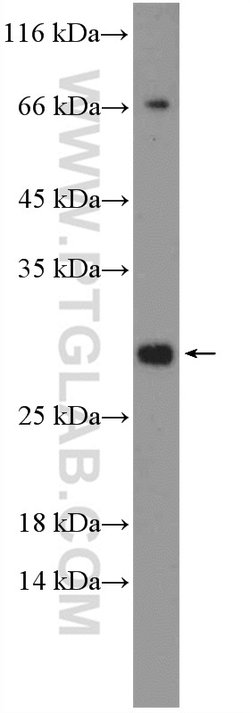 EAF6 Rabbit anti-Human, Polyclonal, Proteintech 150 &mu;L; Unconjugated:Antibodies,