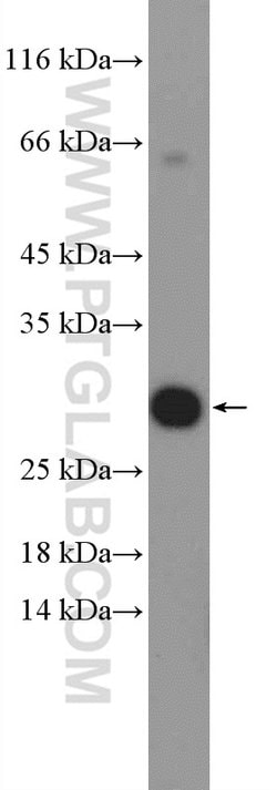 EAF6 Rabbit anti-Human, Polyclonal, Proteintech 150 &mu;L; Unconjugated:Antibodies,
