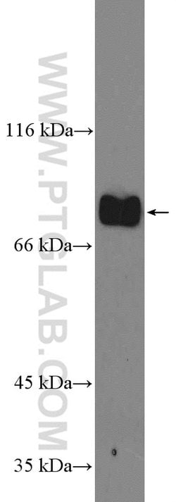GLE1 Rabbit anti-Human, Polyclonal, Proteintech:Antibodies:Primary Antibodies