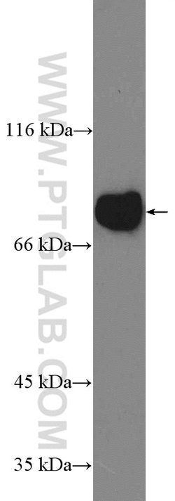 GLE1 Rabbit anti-Human, Polyclonal, Proteintech:Antibodies:Primary Antibodies