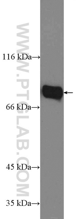 GLE1 Rabbit anti-Human, Polyclonal, Proteintech:Antibodies:Primary Antibodies