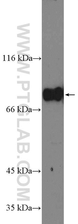 GLE1 Rabbit anti-Human, Polyclonal, Proteintech:Antibodies:Primary Antibodies