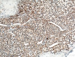OTC Rabbit anti-Human, Mouse, Rat, Polyclonal, Proteintech 150 &mu;L; Unconjugated:Antibodies,